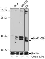 LC3B Monoclonal Antibody (10M5H10)