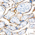 PD-L1 (CD274) Antibody in Immunohistochemistry (Paraffin) (IHC (P))