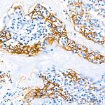 PD-L1 (CD274) Antibody in Immunohistochemistry (Paraffin) (IHC (P))