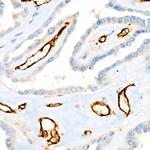 CD31 (PECAM-1) Recombinant Rabbit Monoclonal Antibody (7O7K3)