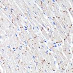 N-cadherin Recombinant Rabbit Monoclonal Antibody (6F9G8)