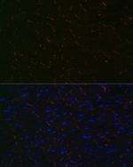 N-cadherin Antibody in Immunohistochemistry (Paraffin) (IHC (P))
