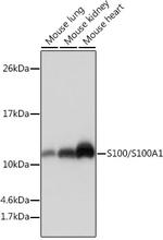 S100A1 Recombinant Rabbit Monoclonal Antibody (5L10L1)