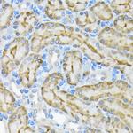 Glycerol kinase Antibody in Immunohistochemistry (Paraffin) (IHC (P))