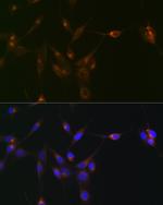 PDLIM1 Recombinant Rabbit Monoclonal Antibody (5X10L2)