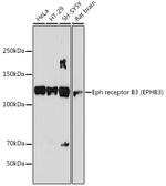 EphB3 Recombinant Rabbit Monoclonal Antibody (8H9P4)