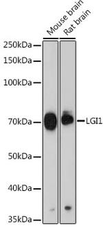 LGI1 Recombinant Rabbit Monoclonal Antibody (2P8Z9)