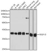 VEGFD Recombinant Rabbit Monoclonal Antibody (9C2U7)