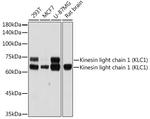KLC1 Recombinant Rabbit Monoclonal Antibody (5C3P5)