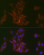 DOK1 Recombinant Rabbit Monoclonal Antibody (6U4U9)