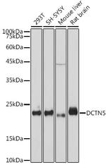 DCTN5 Recombinant Rabbit Monoclonal Antibody (9W2S4)