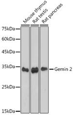 Gemin 2 Antibody in Western Blot (WB)
