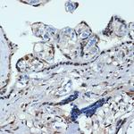 HOXA9 Antibody in Immunohistochemistry (Paraffin) (IHC (P))