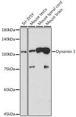 Dynamin 3 Recombinant Rabbit Monoclonal Antibody (5X7T4)