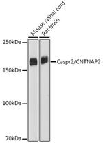 Caspr2 Recombinant Rabbit Monoclonal Antibody (2H2I5)