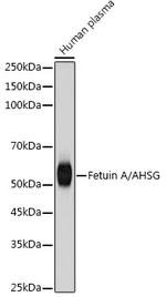 Fetuin A Recombinant Rabbit Monoclonal Antibody (1A4W5)