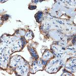 NLK Recombinant Rabbit Monoclonal Antibody (6G5V10)