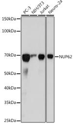 NUP62 Recombinant Rabbit Monoclonal Antibody (4V10S5)