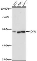 ACVR1 Recombinant Rabbit Monoclonal Antibody (1J7G4)