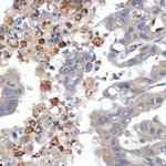 Trypsin 2 Recombinant Rabbit Monoclonal Antibody (3D9O7)