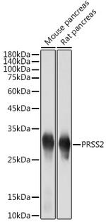 Trypsin 2 Antibody in Western Blot (WB)