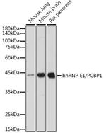 PCBP1 Antibody in Western Blot (WB)