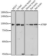ATRIP Recombinant Rabbit Monoclonal Antibody (2C4B6)