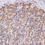 CTNNA3 Antibody in Immunohistochemistry (Paraffin) (IHC (P))