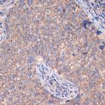 CTNNA3 Recombinant Rabbit Monoclonal Antibody (8F1U7)