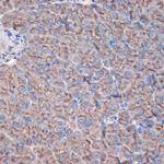 CTNNA3 Antibody in Immunohistochemistry (Paraffin) (IHC (P))