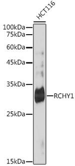 Pirh2 Recombinant Rabbit Monoclonal Antibody (4Q5H9)