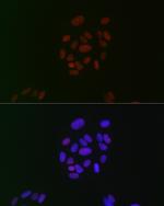 CIRBP Recombinant Rabbit Monoclonal Antibody (3V9S7)