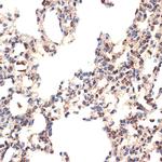 BCL2L14 Antibody in Immunohistochemistry (Paraffin) (IHC (P))