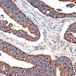 BCL2L14 Antibody in Immunohistochemistry (Paraffin) (IHC (P))