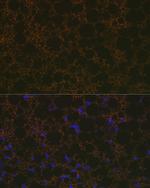 UCP1/UCP3 Recombinant Rabbit Monoclonal Antibody (0S10O10)