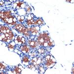 UCP1/UCP3 Antibody in Immunohistochemistry (Paraffin) (IHC (P))