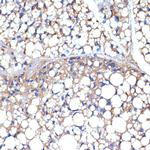 UCP1/UCP3 Antibody in Immunohistochemistry (Paraffin) (IHC (P))