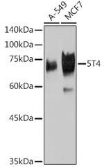 5T4 Recombinant Rabbit Monoclonal Antibody (2K10S6)
