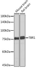 TBR1 Recombinant Rabbit Monoclonal Antibody (1U1K5)