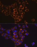 Caspase 6 Antibody in Immunocytochemistry (ICC/IF)