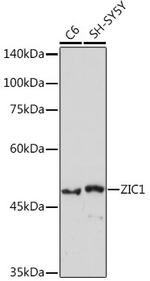 ZIC1 Recombinant Rabbit Monoclonal Antibody (6B5O9)