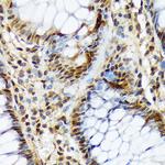 COPS3 Antibody in Immunohistochemistry (Paraffin) (IHC (P))