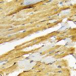 COPS3 Antibody in Immunohistochemistry (Paraffin) (IHC (P))