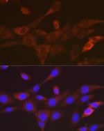 TACC3 Recombinant Rabbit Monoclonal Antibody (7S7L2)