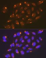 TGN46 Antibody in Immunocytochemistry (ICC/IF)