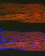 SERCA1 ATPase Antibody in Immunocytochemistry (ICC/IF)