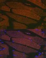 SERCA1 ATPase Recombinant Rabbit Monoclonal Antibody (2T8S3)