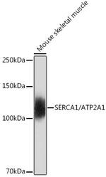 SERCA1 ATPase Antibody in Western Blot (WB)