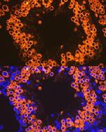 CLGN Recombinant Rabbit Monoclonal Antibody (8R8M1)