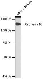 CDH16 Recombinant Rabbit Monoclonal Antibody (2J0H4)